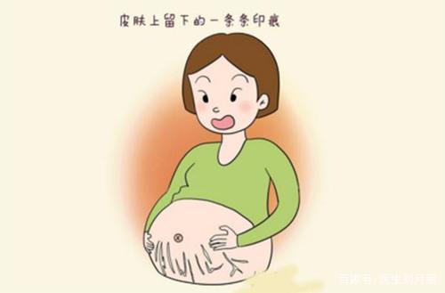 妊娠纹去除多少钱？